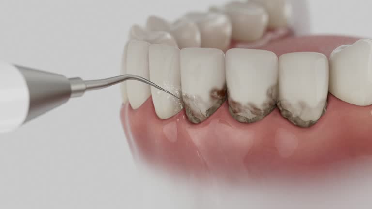 Trusted Teeth Cleaning And Checkup service in McCormick, SC - Dentist Open Now
